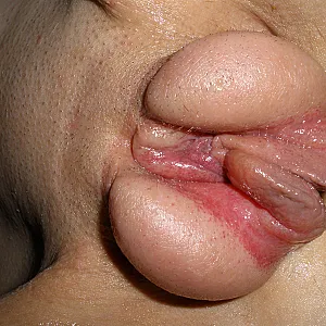 fat pussy gallery image