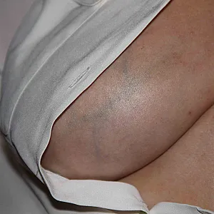 my Tits gallery image