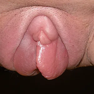 pussy and clitvacuum gallery image