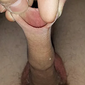 foreskin fun gallery image