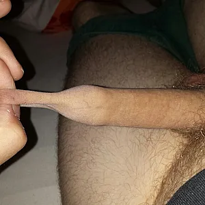 foreskin fun gallery image