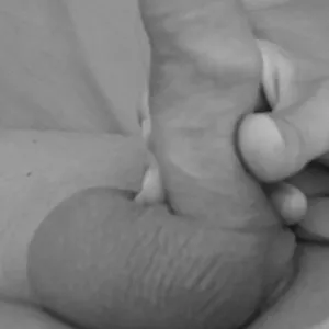penis b/w gallery image
