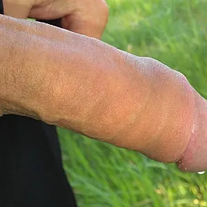 my cock gallery image