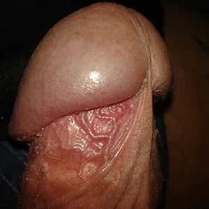 First image of sperma12's Gallery - close 1