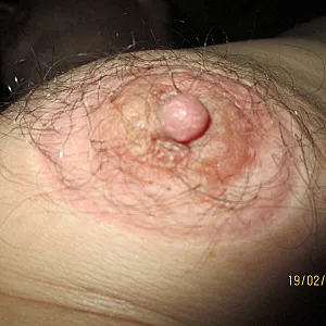 nippel Galeriebild