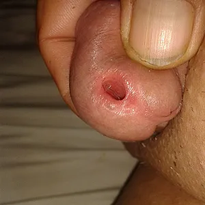 First image of sperma12's Gallery - sperm and piss hole