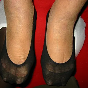 my feets gallery image