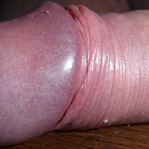 really closeup gallery image