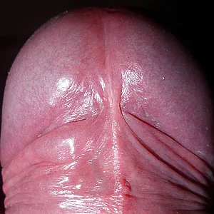 really closeup gallery image