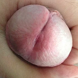 my cock gallery image