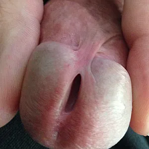 my cock gallery image