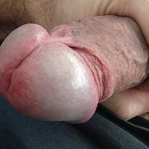 my cock gallery image