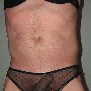 black gallery image