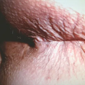 really really closeup 2 gallery image