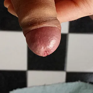 closeup gallery image
