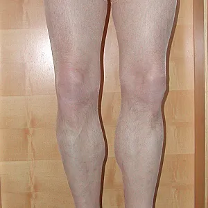 Neue Heels 1 Galeriebild