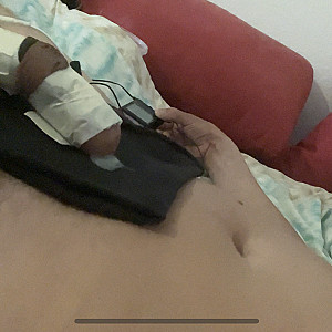 estim gallery image