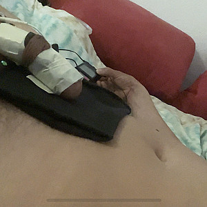 estim gallery image