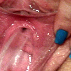 pissing gallery image