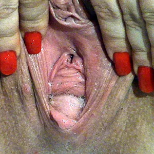 Votzenpiss Bilder Galeriebild