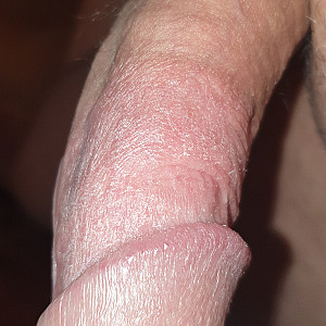 my dick III gallery image