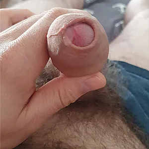 my dick gallery image