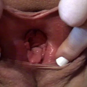 Pissloch, lange Schamlippen und sexy Fotze Galeriebild