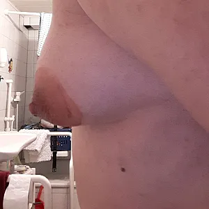 breast gallery image