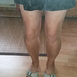 Mit  Rock und  Leggins Galeriebild