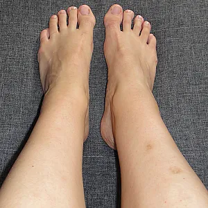 Legs and feet gallery image