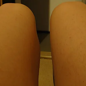 Legs and feet gallery image