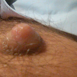 My nipples gallery image
