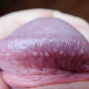closeups gallery image