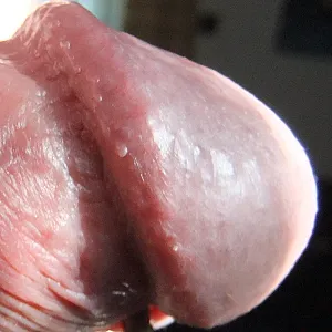 closeups gallery image
