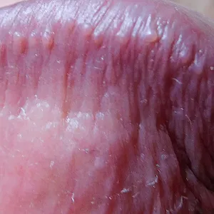 closeups gallery image