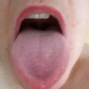 Milf gallery image