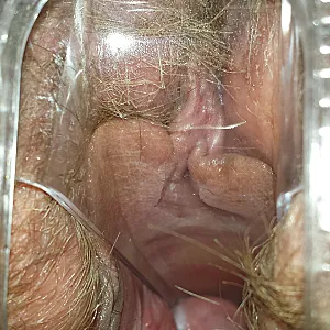 nipple pump gallery image