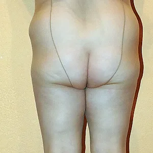 showing off gallery image