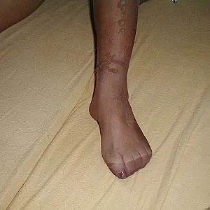 cuckold bitch gallery image