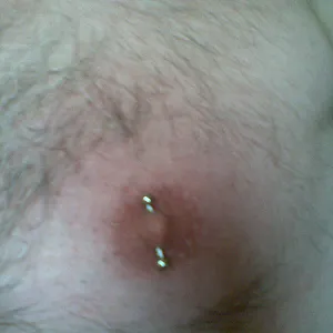 Ringe, Ringe, Ringe Galeriebild