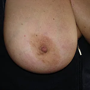 huge tits gallery image