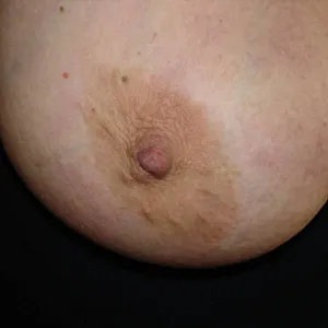 huge tits gallery image
