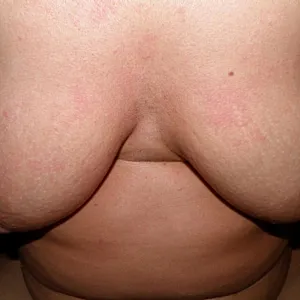 My breast outdoors Galeriebild