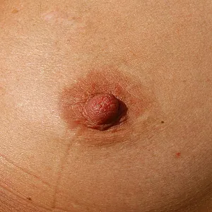 Tit Massage gallery image