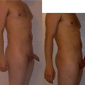 my body Galeriebild
