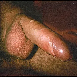 Haarig... Galeriebild