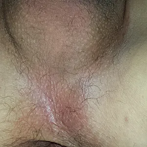 butt cock foreskin gallery image