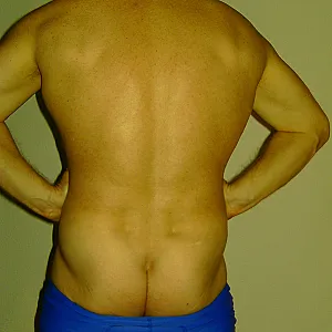 Backviews gallery image
