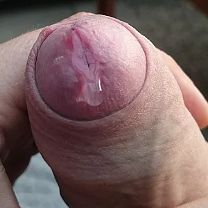 My dick gallery image