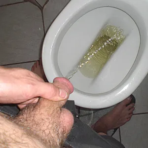 toilett gallery image